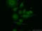Structural Maintenance Of Chromosomes 5 antibody, 14178-1-AP, Proteintech Group, Immunofluorescence image 