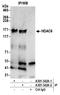 Histone Deacetylase 6 antibody, A301-342A, Bethyl Labs, Immunoprecipitation image 