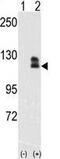 EPH Receptor B2 antibody, GTX81348, GeneTex, Western Blot image 