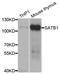 SATB Homeobox 1 antibody, TA332923, Origene, Western Blot image 
