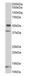 Neuronal pentraxin-1 antibody, orb137172, Biorbyt, Western Blot image 