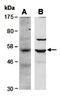 BCL6B Transcription Repressor antibody, orb67053, Biorbyt, Western Blot image 