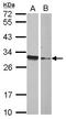 High Mobility Group Box 4 antibody, LS-C155681, Lifespan Biosciences, Western Blot image 