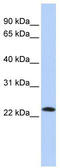 Stromal Cell Derived Factor 2 antibody, TA346757, Origene, Western Blot image 