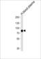 Leucine Rich Repeat Containing 45 antibody, LS-C165884, Lifespan Biosciences, Western Blot image 
