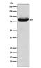 MALT1 antibody, M01599-2, Boster Biological Technology, Western Blot image 