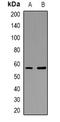 Anoctamin 9 antibody, orb382458, Biorbyt, Western Blot image 