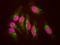 Lysosomal Associated Membrane Protein 1 antibody, LS-B10407, Lifespan Biosciences, Immunocytochemistry image 