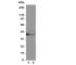Methyl-CpG Binding Domain Protein 1 antibody, R31151, NSJ Bioreagents, Western Blot image 