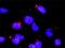 Protein Phosphatase, Mg2+/Mn2+ Dependent 1B antibody, H00005495-M01, Novus Biologicals, Proximity Ligation Assay image 