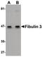 EGF Containing Fibulin Extracellular Matrix Protein 1 antibody, PA5-20761, Invitrogen Antibodies, Western Blot image 