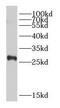 Leukemia-associated protein 1 antibody, FNab02408, FineTest, Western Blot image 