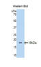 Polybromo 1 antibody, LS-C374923, Lifespan Biosciences, Western Blot image 