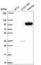 Phosphatidylinositol-4,5-Bisphosphate 3-Kinase Catalytic Subunit Beta antibody, HPA064207, Atlas Antibodies, Western Blot image 