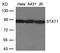 Signal Transducer And Activator Of Transcription 1 antibody, GTX50401, GeneTex, Western Blot image 