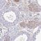 ADAM Metallopeptidase Domain 21 antibody, HPA059016, Atlas Antibodies, Immunohistochemistry paraffin image 