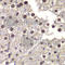 Suppression Of Tumorigenicity 14 antibody, A6135, ABclonal Technology, Immunohistochemistry paraffin image 