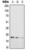 Rah1 antibody, LS-C353827, Lifespan Biosciences, Western Blot image 