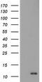 S100 Calcium Binding Protein A12 antibody, M01478, Boster Biological Technology, Western Blot image 