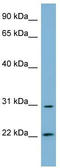 Hydroxysteroid 17-Beta Dehydrogenase 14 antibody, TA345049, Origene, Western Blot image 