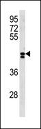 Leucine Rich Repeat Containing 2 antibody, PA5-49305, Invitrogen Antibodies, Western Blot image 