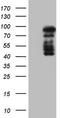 Histone Deacetylase 9 antibody, TA805328S, Origene, Western Blot image 