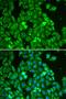 Signal transducer and activator of transcription 1 antibody, orb49089, Biorbyt, Immunofluorescence image 