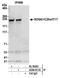 Protein SOGA1 antibody, A304-911A, Bethyl Labs, Immunoprecipitation image 