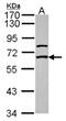 Gamma-Aminobutyric Acid Type A Receptor Epsilon Subunit antibody, NBP2-21572, Novus Biologicals, Western Blot image 