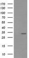 Retinoic Acid Receptor Responder 1 antibody, TA506084AM, Origene, Western Blot image 