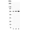 Dopamine Receptor D2 antibody, R31358, NSJ Bioreagents, Western Blot image 