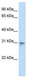 Transcription Factor A, Mitochondrial antibody, TA341819, Origene, Western Blot image 