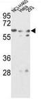 Glucosamine (N-Acetyl)-6-Sulfatase antibody, GTX81833, GeneTex, Western Blot image 