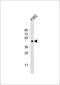 LUC7 Like antibody, 62-523, ProSci, Western Blot image 