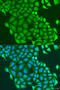 HAUS augmin-like complex subunit 6 antibody, 19-471, ProSci, Immunofluorescence image 