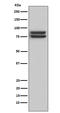 Forkhead Box P1 antibody, M00723-1, Boster Biological Technology, Western Blot image 