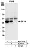 Eukaryotic translation initiation factor 3 subunit M antibody, A304-761A, Bethyl Labs, Immunoprecipitation image 