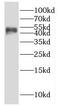 Galactose-1-phosphate uridylyltransferase antibody, FNab03330, FineTest, Western Blot image 