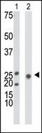 Ketohexokinase antibody, 62-632, ProSci, Western Blot image 