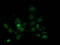 Nicotinamide N-Methyltransferase antibody, LS-C172704, Lifespan Biosciences, Immunofluorescence image 