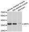 ADP-Ribosyltransferase 5 antibody, STJ29226, St John