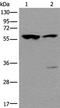 Zinc finger protein RFP antibody, PA5-67533, Invitrogen Antibodies, Western Blot image 
