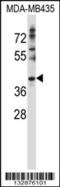 DnaJ Heat Shock Protein Family (Hsp40) Member C28 antibody, 57-145, ProSci, Western Blot image 