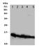 NADH:Ubiquinone Oxidoreductase Subunit A1 antibody, PA1661, Boster Biological Technology, Western Blot image 
