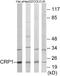 Cysteine And Glycine Rich Protein 1 antibody, EKC1690, Boster Biological Technology, Western Blot image 