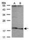 Sodium Voltage-Gated Channel Beta Subunit 3 antibody, PA5-28043, Invitrogen Antibodies, Western Blot image 
