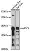 ATP Binding Cassette Subfamily C Member 6 antibody, 23-399, ProSci, Western Blot image 