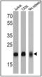 CD3d Molecule antibody, MA5-14524, Invitrogen Antibodies, Western Blot image 