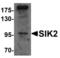 Salt Inducible Kinase 2 antibody, LS-B7103, Lifespan Biosciences, Western Blot image 