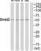 HsMAD2 antibody, TA312260, Origene, Western Blot image 